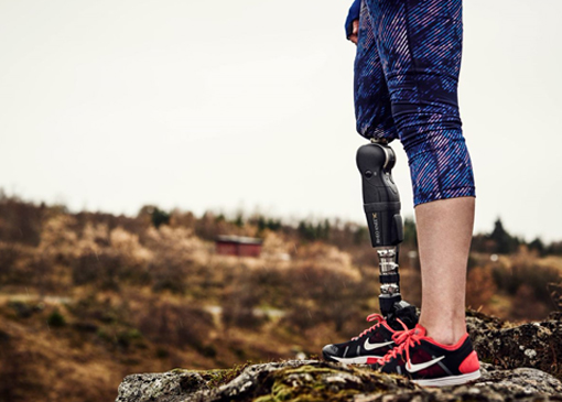 Prosthetic, Orthotic &amp; Rehab Clinic Surehab